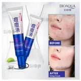 Bioaqua High quality Cream to remove dark spots on the Face Pure Skin Acne Removal Anti-Wrinkle Treatment Cream BQY00026