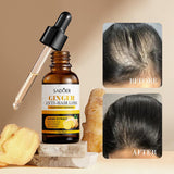 Pack Of 02 Hair Growth Oil Derma Roller 0.55mm For Faster Hair Growth