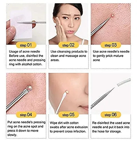 Miss Extractor (1 Pc) Blackhead Remover Pin Needle Extractor Acne Pimple Cleaning Too ...