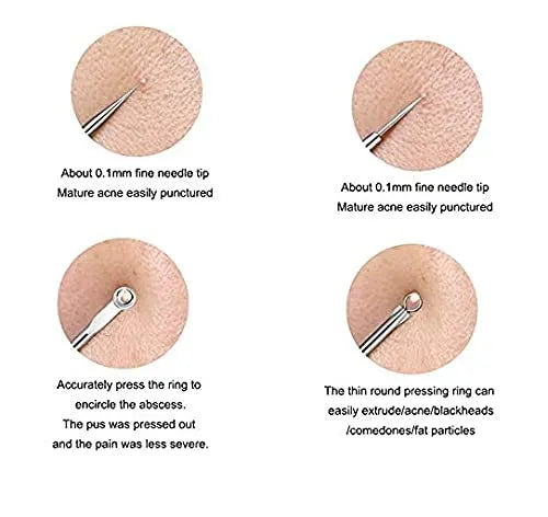 Miss Extractor (1 Pc) Blackhead Remover Pin Needle Extractor Acne Pimple Cleaning Too ...
