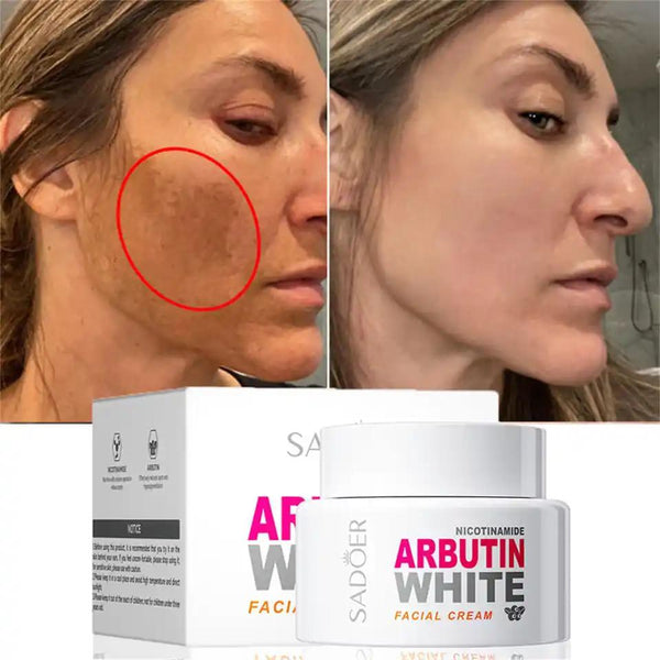 Sadoer Nicotinamide Arbutin White Facial Cream Anti-aging Brighten Beauty Korean Skin Care 50g - SD89149