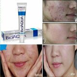 BIOAQUA Natural Pink Lips Balm Cream & Acne Cream.