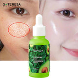 Bioaqua Avocado Facial Moisturizing Cream & White Firming Skin Care Korean Anti-Acne Serum