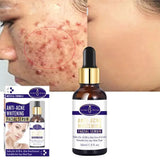 Aichun Beauty Glowing Remover Scars Facial Serum - 30ML - AC31952