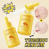 BIOAQUA Turmeric Facial Serum Skin Hyaluronic Acid Control Oil Moisturizing Face Skin For Girls & Women 30ml BQY00782