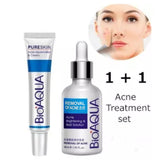 BIOAQUA 2 Pcs Anti Acne Removal Face Care Acne Treatment Set Acne Serum and Acne Scar Removal Cream